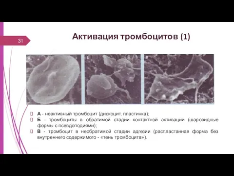 Активация тромбоцитов (1) А - неактивный тромбоцит (дискоцит, пластинка); Б