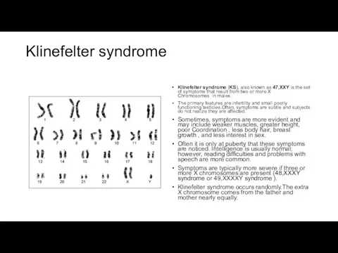 Klinefelter syndrome Klinefelter syndrome (KS), also known as 47,XXY is