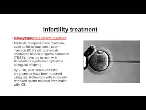 Infertility treatment Intracytoplasmic Sperm injection: Methods of reproductive medicine, such