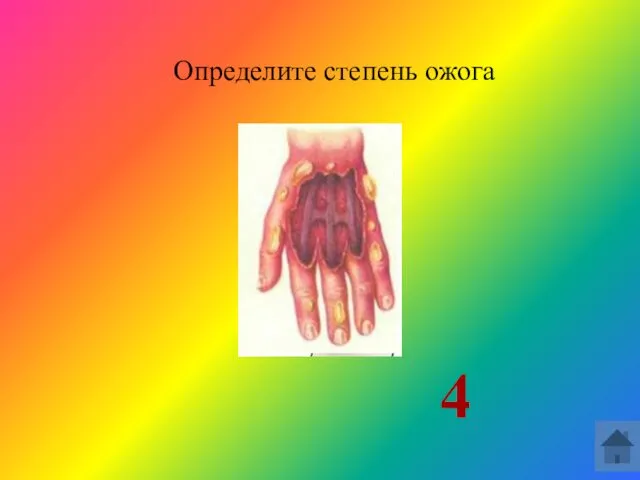 Определите степень ожога 4