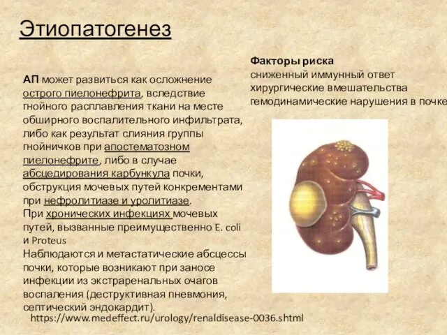 Этиопатогенез Факторы риска сниженный иммунный ответ хирургические вмешательства гемодинамические нарушения