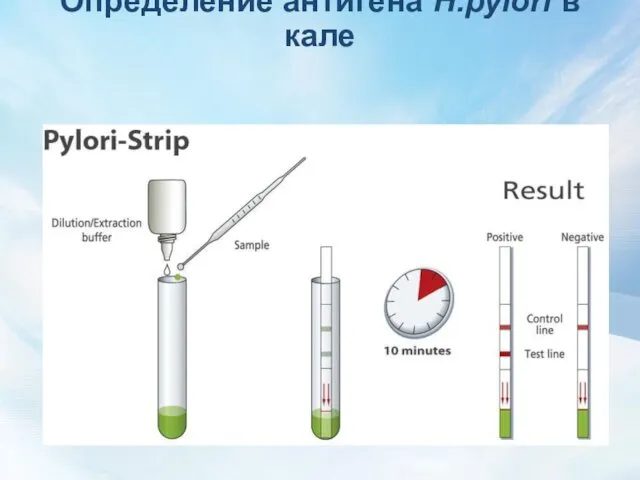 Определение антигена H.pylori в кале