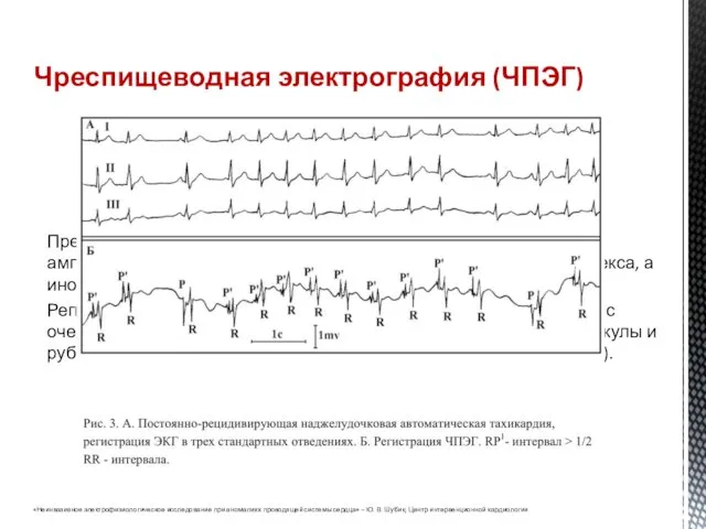 Преимущество ЧПЭГ перед обычной ЭКГ заключается в том, что амплитуда