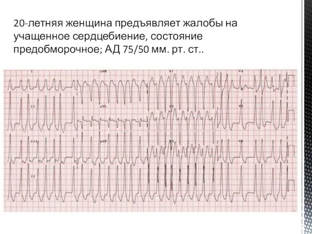 20-летняя женщина предъявляет жалобы на учащенное сердцебиение, состояние предобморочное; АД 75/50 мм. рт. ст..