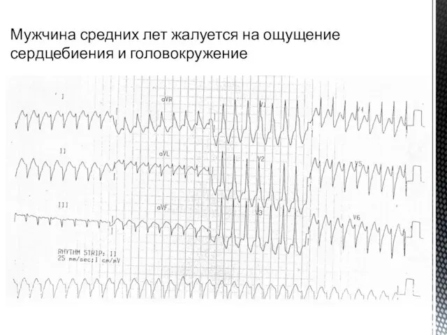 Мужчина средних лет жалуется на ощущение сердцебиения и головокружение