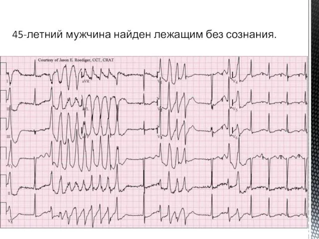 45-летний мужчина найден лежащим без сознания.