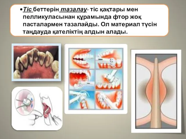 Тіс беттерін тазалау- тіс қақтары мен пелликуласынан құрамында фтор жоқ