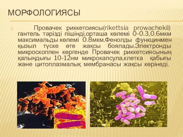 МОРФОЛОГИЯСЫ Провачек риккетсиясы(rikettsia prowachekii) гантель тәрізді пішінді,орташа көлемі 0-0.3,0.6мкм максимальды