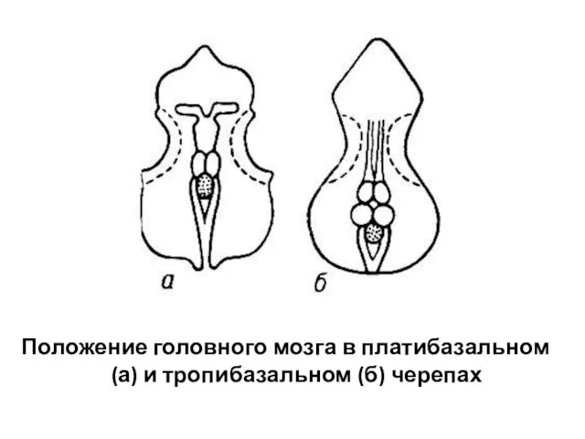 Положение головного мозга в платибазальном (а) и тропибазальном (б) черепах
