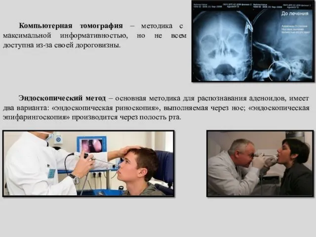 Компьютерная томография – методика с максимальной информативностью, но не всем