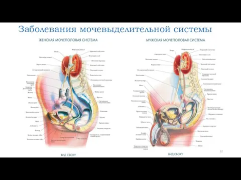 Заболевания мочевыделительной системы