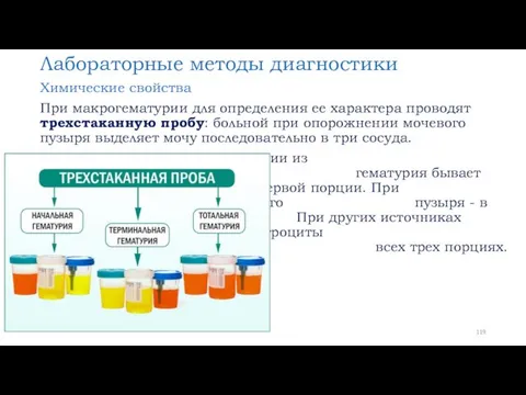 Лабораторные методы диагностики Химические свойства При макрогематурии для определения ее