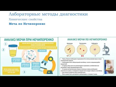 Лабораторные методы диагностики Химические свойства Моча по Нечипоренко