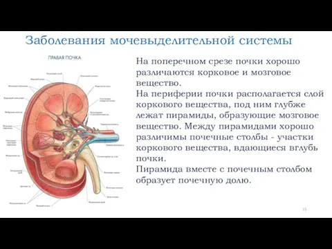 Заболевания мочевыделительной системы На поперечном срезе почки хорошо различаются корковое