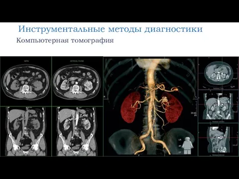 Инструментальные методы диагностики Компьютерная томография