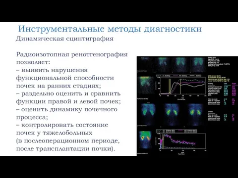 Инструментальные методы диагностики Динамическая сцинтиграфия Радиоизотопная ренотгенография позволяет: – выявить