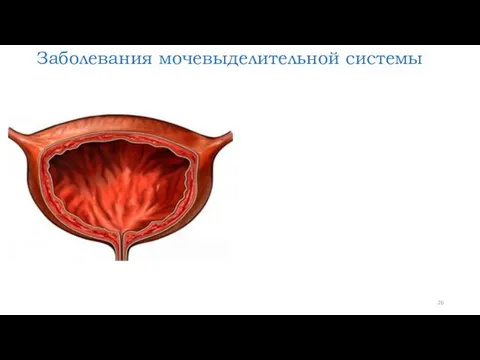 Заболевания мочевыделительной системы