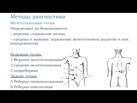 Методы диагностики Мочеточниковые точки Определяют их болезненность: – верхняя: поражение