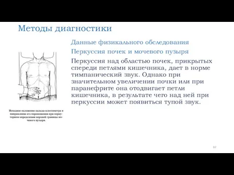 Методы диагностики Данные физикального обследования Перкуссия почек и мочевого пузыря