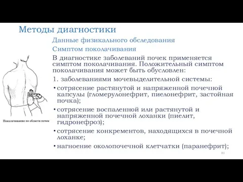 Методы диагностики Данные физикального обследования Симптом поколачивания В диагностике заболеваний