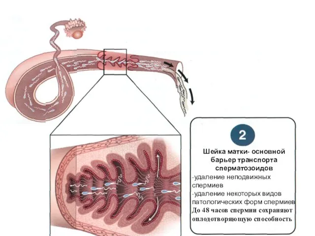 Шейка матки- основной барьер транспорта сперматозоидов -удаление неподвижных спермиев -удаление некоторых видов патологических