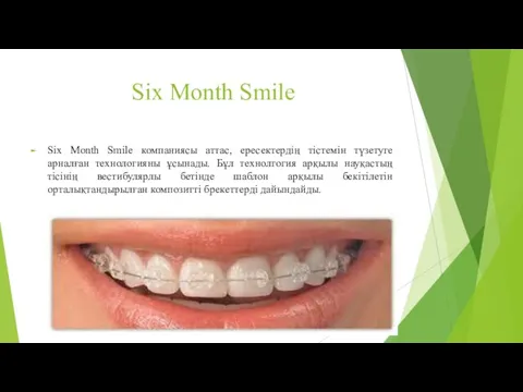 Six Month Smile Six Month Smile компаниясы аттас, ересектердің тістемін