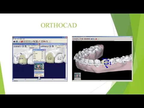 ORTHOCAD