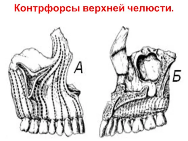 Контрфорсы верхней челюсти.