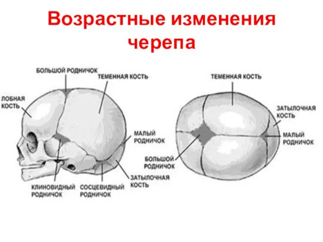 Возрастные изменения черепа