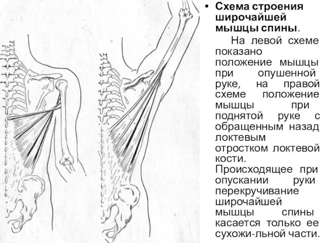Схема строения широчайшей мышцы спины. На левой схеме показано положение мышцы при опушенной