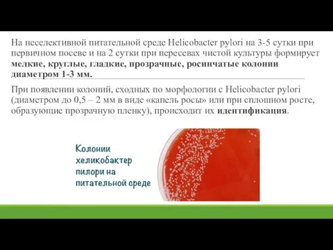 На неселективной питательной среде Helicobacter pylori на 3-5 сутки при