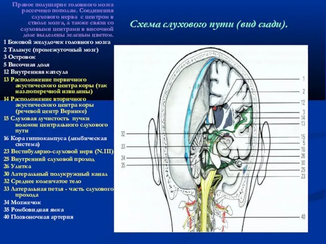 Схема слухового пути (вид сзади). Правое полушарие головного мозга рассечено