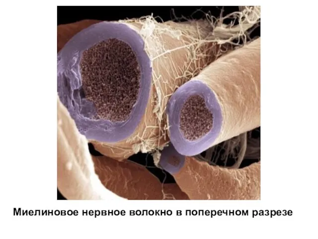 Миелиновое нервное волокно в поперечном разрезе
