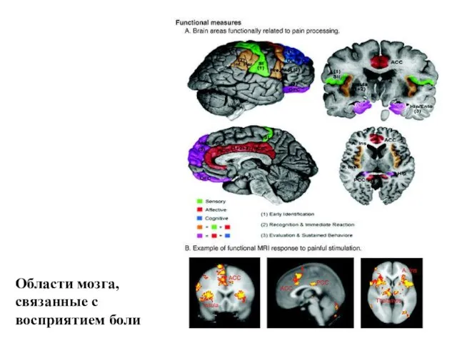 Области мозга, связанные с восприятием боли
