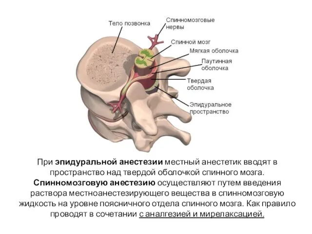 При эпидуральной анестезии местный анестетик вводят в пространство над твердой