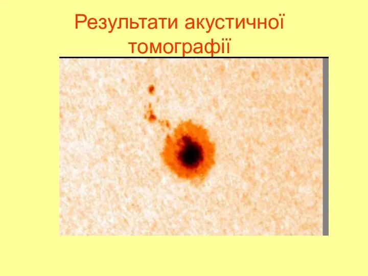 Результати акустичної томографії