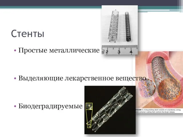 Стенты Простые металлические Выделяющие лекарственное вещество Биодеградируемые