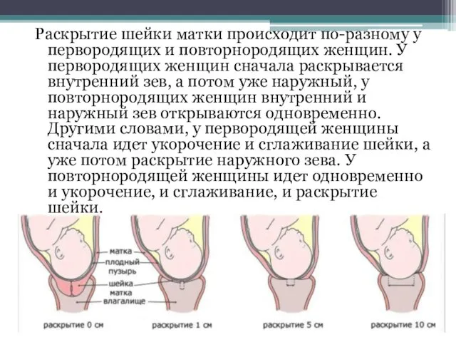 Раскрытие шейки матки происходит по-разному у первородящих и повторнородящих женщин.