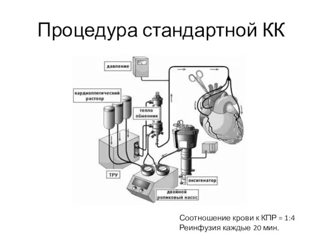 Процедура стандартной КК Соотношение крови к КПР = 1:4 Реинфузия каждые 20 мин.