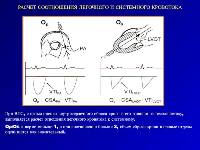 РАСЧЕТ СООТНОШЕНИЯ ЛЕГОЧНОГО И СИСТЕМНОГО КРОВОТОКА При ВПС, с целью