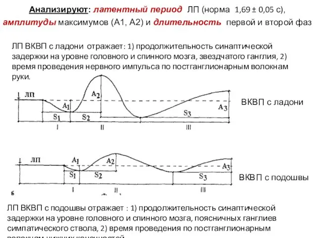Анализируют: латентный период ЛП (норма 1,69 ± 0,05 с), амплитуды максимумов (А1, А2)