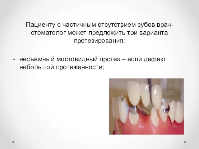 Пациенту с частичным отсутствием зубов врач-стоматолог может предложить три варианта