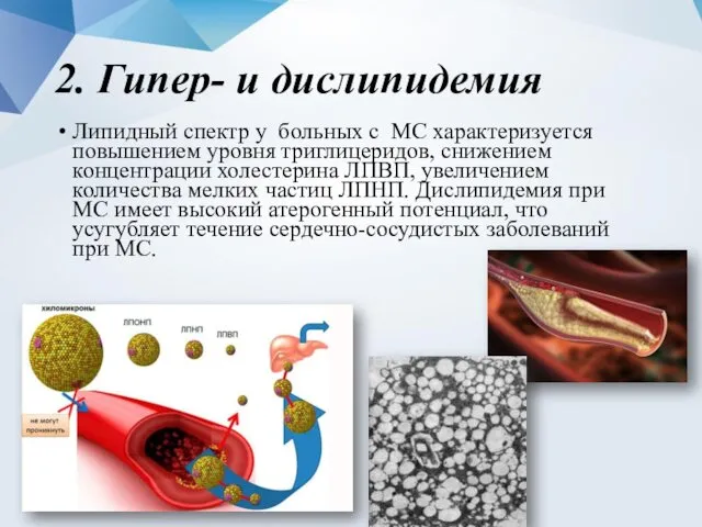 2. Гипер- и дислипидемия Липидный спектр у больных с МС характеризуется повышением уровня