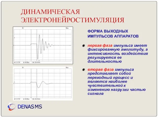 ДИНАМИЧЕСКАЯ ЭЛЕКТРОНЕЙРОСТИМУЛЯЦИЯ ФОРМА ВЫХОДНЫХ ИМПУЛЬСОВ АППАРАТОВ первая фаза импульса имеет