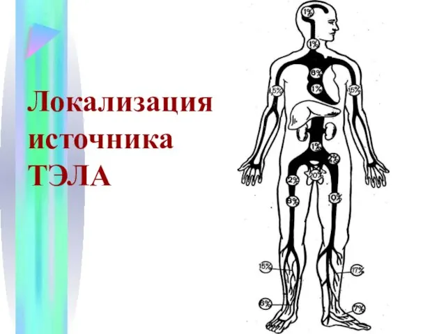 Локализация источника ТЭЛА