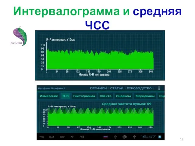 Интервалограмма и средняя ЧСС