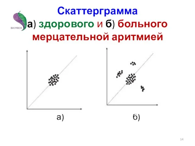 Скаттерграмма а) здорового и б) больного мерцательной аритмией а) б)