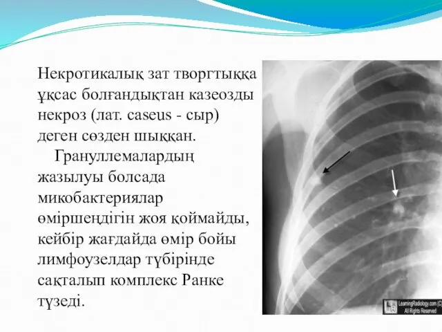 Некротикалық зат творгтыққа ұқсас болғандықтан казеозды некроз (лат. caseus -