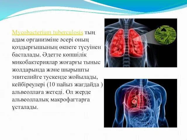 Mycobacterium tuberculosis тың адам организміне әсері оның қоздырғышының өкпеге түсуінен