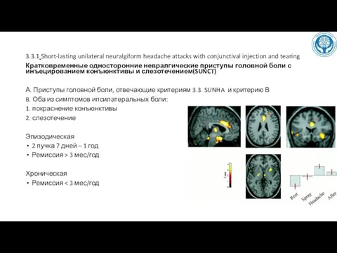 3.3.1 Short-lasting unilateral neuralgiform headache attacks with conjunctival injection and